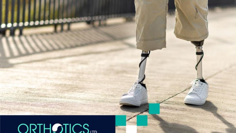 A walking man with prosthetic legs and white sneakers