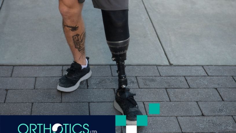 An amputee wearing a prosthetic