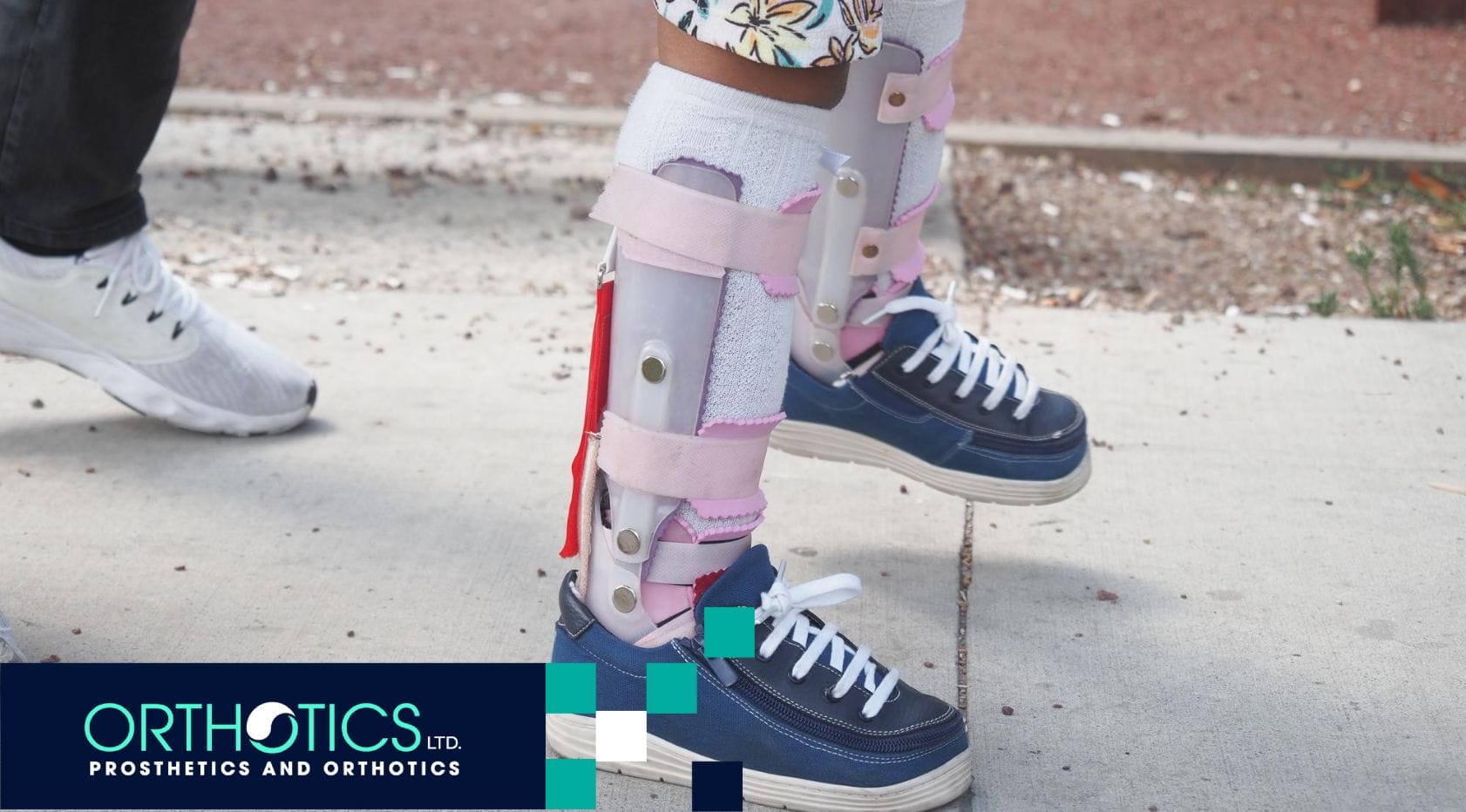 Common Challenges With Pediatric Prosthetics