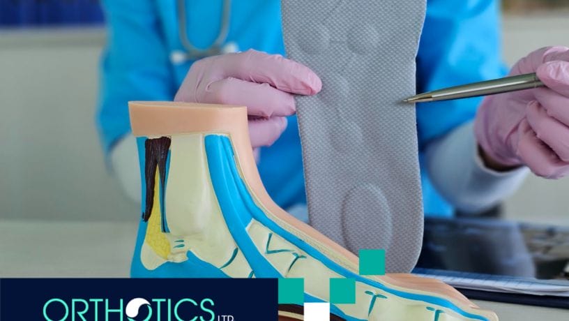 A medical assistant holding an orthotic insole, with a model of a foot on a table