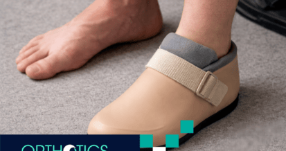 A partial foot amputee wearing a shoe