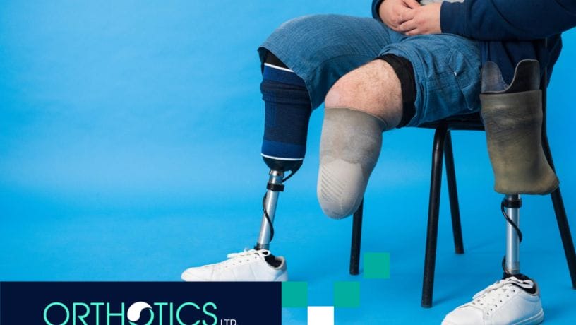 An amputee sitting on a chair