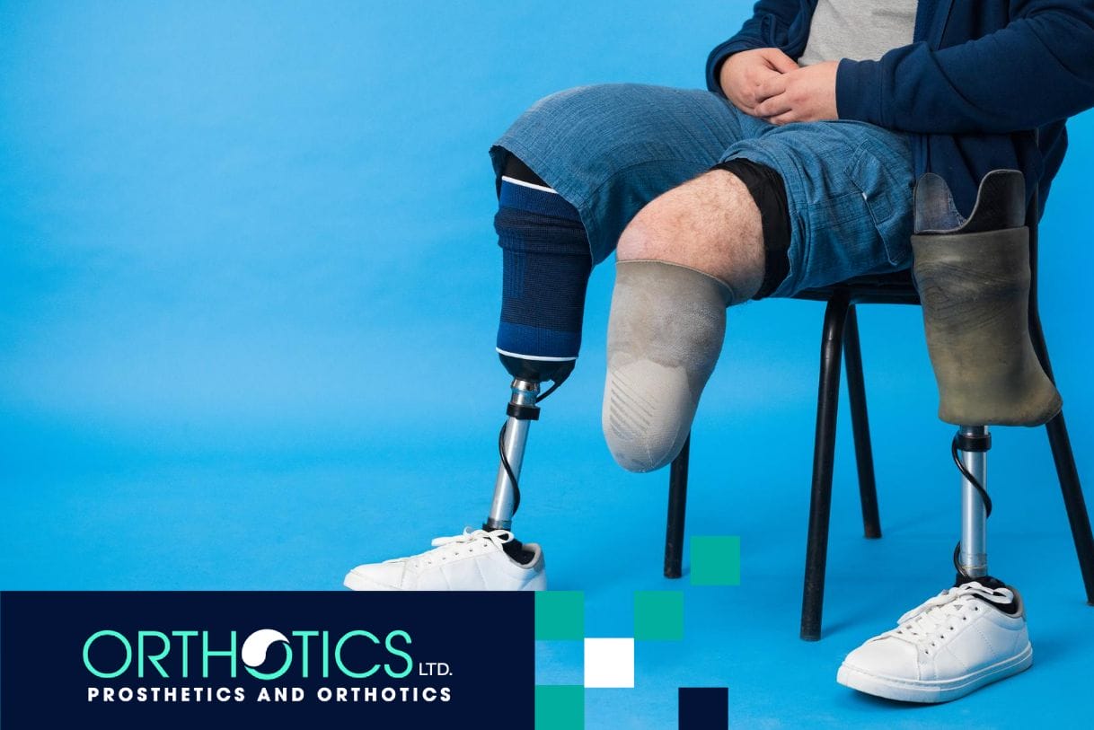 An amputee sitting on a chair